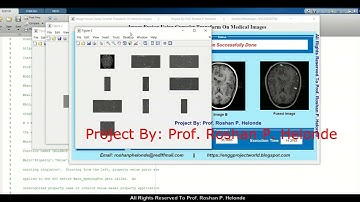 Image Fusion Using Curvelet Transform Technique | Medical Image Fusion Using Matlab Project Code