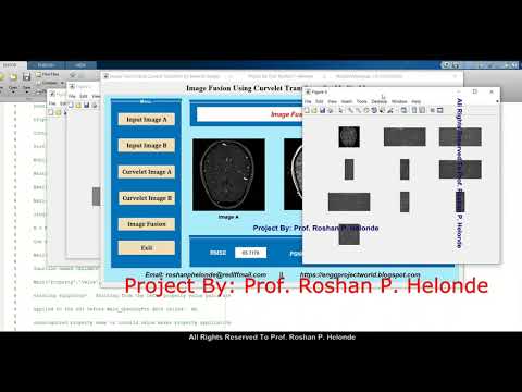 Image Fusion Using Curvelet Transform Technique | Medical Image Fusion Using Matlab Project Code