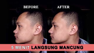 Tips Memancungkan Hidung Tanpa Operasi Plastik