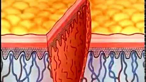 Wound Healing Part 1 - DayDayNews