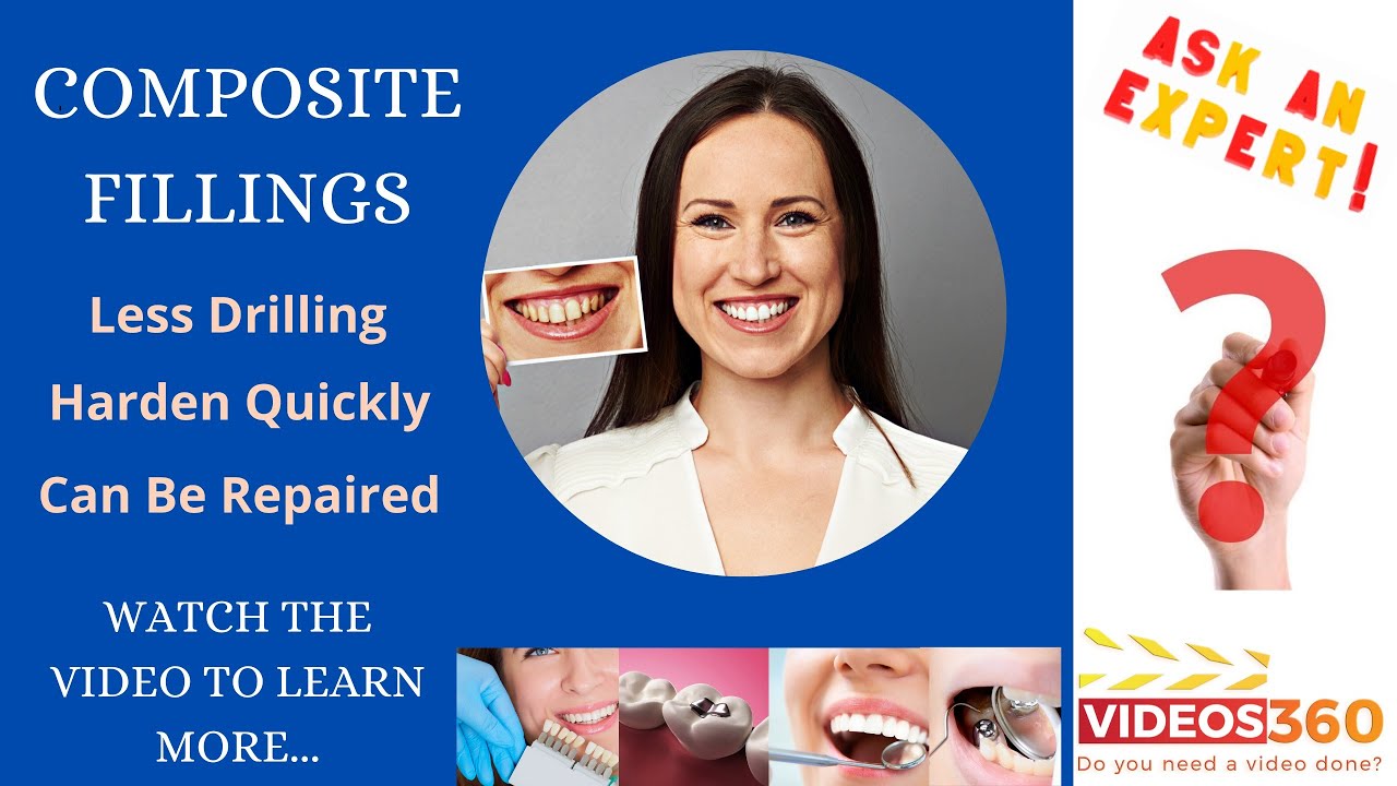 Composite fillings explained by Dr. Troy Schmedding