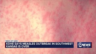 KDHE says measles outbreak over in SW Kansas
