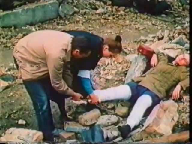 Первая помощь при переломах