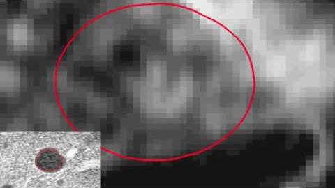 AdaptSet - Deep Learning for Cancer Lesion Segmentation