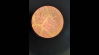 large intestine Colon, Rectum and appendix