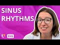 EKG Interpretation - Sinus Rhythms