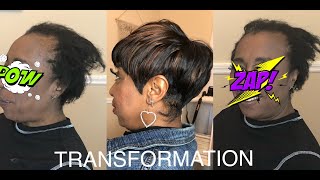 QUICKWEAVE &amp; RELAXER ON CLIENT WITH ALOPECIA | HAIR TRANSFORMATION
