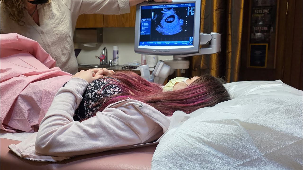 seeing my baby for the first time