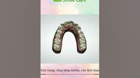 Smilesalign - Niềng răng trong suốt Số 1 Việt Nam