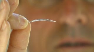 Implants Contraceptifs Définitifs Jai 39 Ans Mais Jai Le Corps Dune Femme De 60 Ans