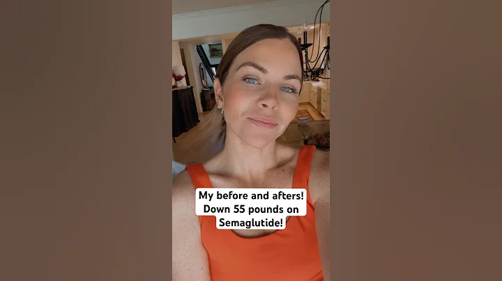 SEMAGLUTIDE BEFORE AND AFTERS link in bio for my provider! #wegovyweightloss #mounjaro #semaglutide