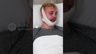 jake pual broke his jaw