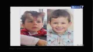 Download Lagu On The Spot Trans 7 - 7 Manusia Unik Dan Aneh Yang Mempunyai Tanduk MP3