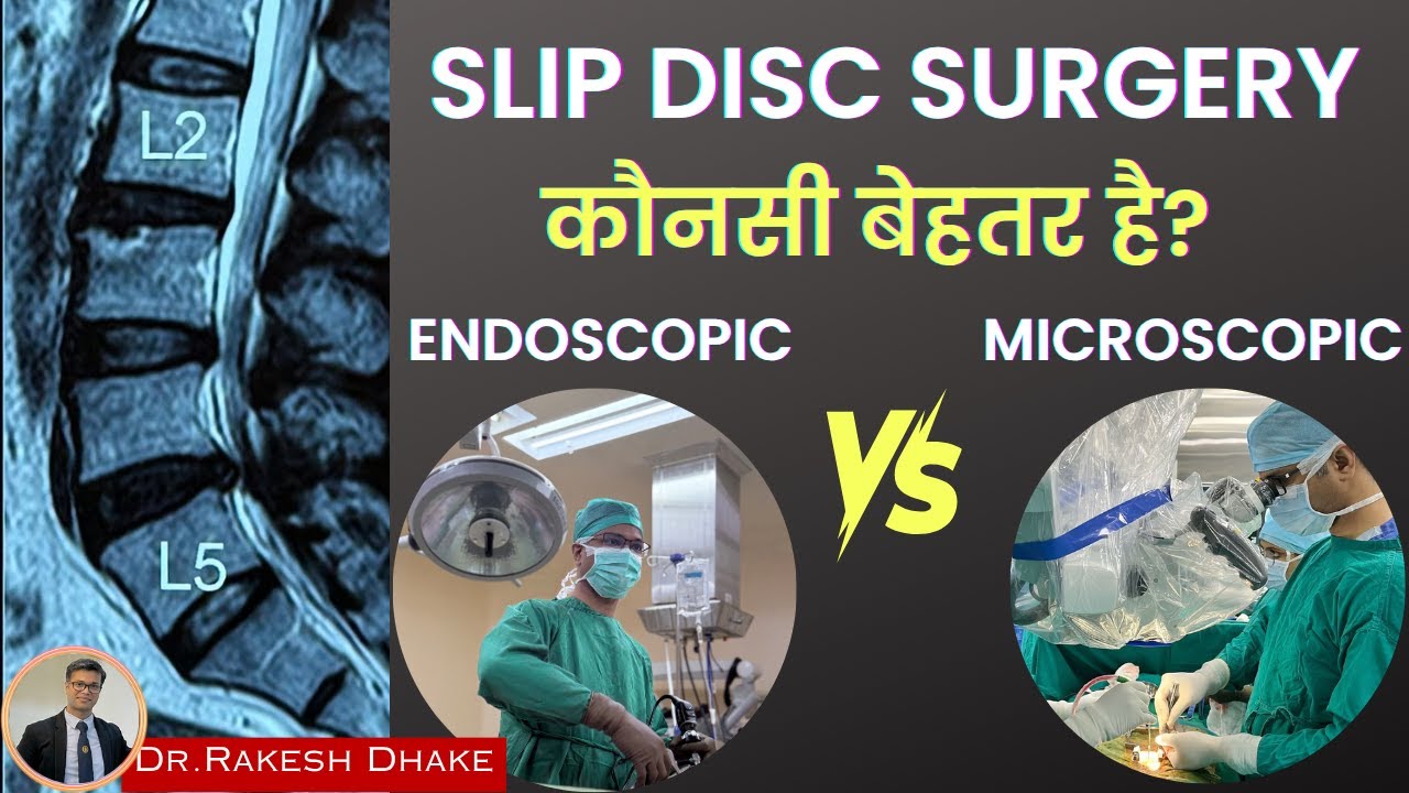 Slip Disc Surgery: Endoscope बेहतर या Microscope? सच्चाई जानिए!