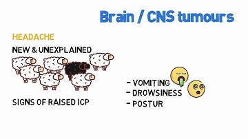 MRCGP CSA Crammers: Brain / CNS red flags