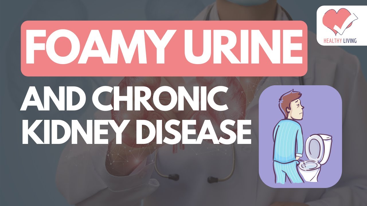 Is Foamy Urine Is A Sign Of Chronic Kidney Disease? 365Living YouTube