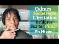 Skincare routine peau sche noire meilleurs produits hydratant et traitement hiver peau noire