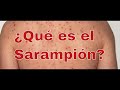 ¿Qué es el Sarampión?