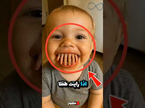 إي اك أن ت طيل النظر إلى هذا الطفل أ سنان ه كابوس م خيف