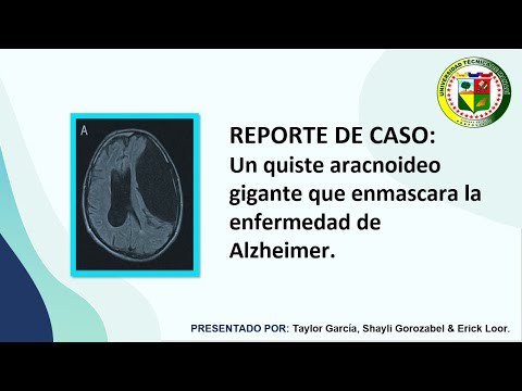 Vídeo: Validación Clínica De Los Análisis De Líquido Cefalorraquídeo Lumipulse G Para El Diagnóstico De Rutina De La Enfermedad De Alzheimer