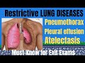 RESPIRATORY DISORDER Medical Surgical For Exit Exam Preparation RESPIRATORY DISORDER Medical Surgical For Exit Exam Preparation