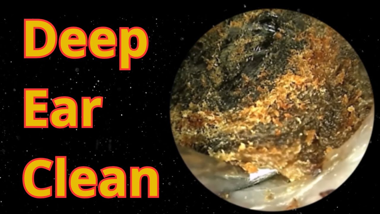 Deep Ear Clean - YouTube