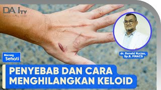 Penyebab dan Cara Menghilangkan Keloid | Bincang Sehati