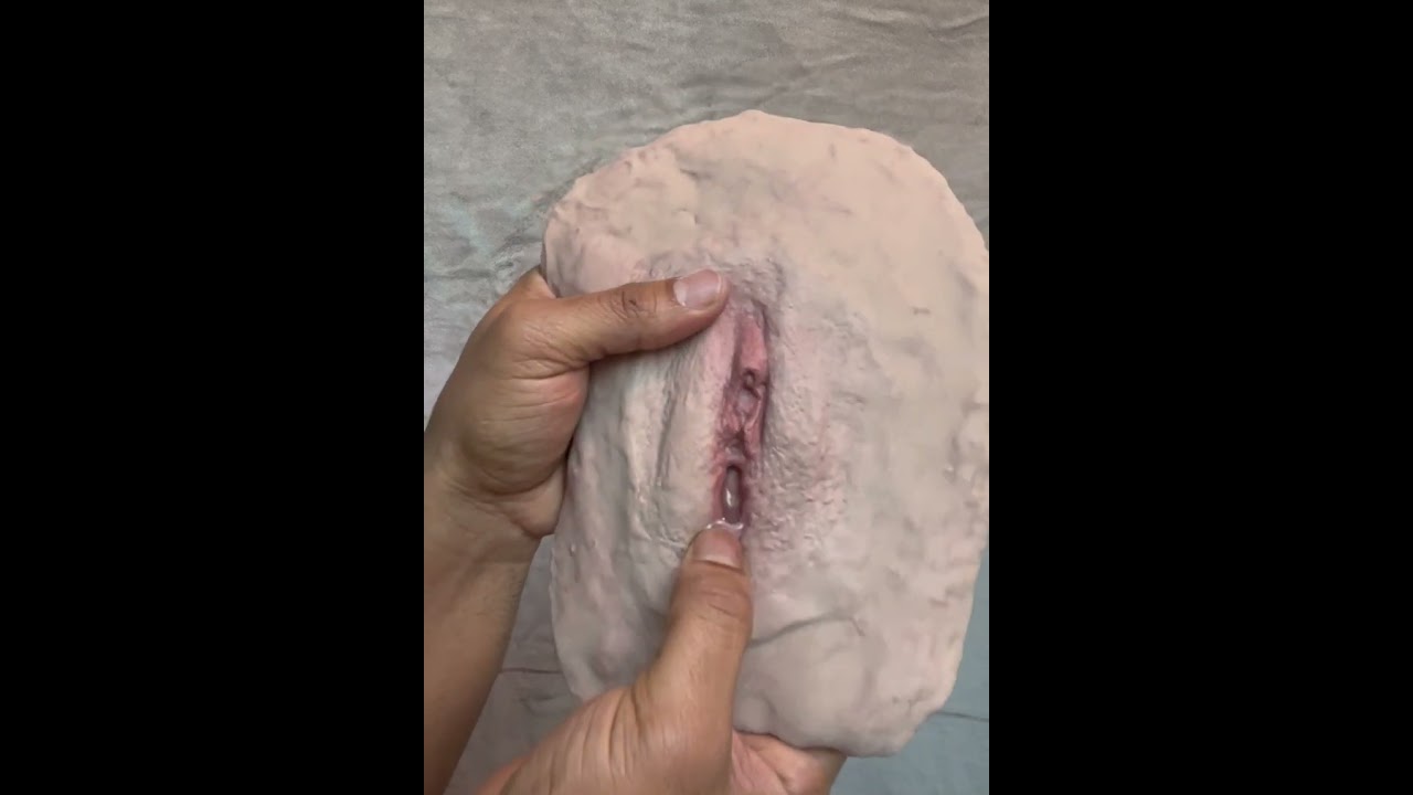 Prosthetic alternative for trans women