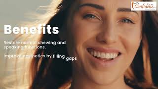 Fixed Partial Dentures, commonly known as dental bridges, offer a transformative solution for tho...