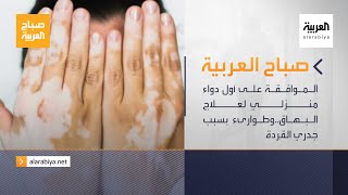 صباح العربية الحلقة الكاملة | الموافقة على أول دواء منزلي لعلاج البهاق..وطوارىء بسبب جدري القردة screenshot 5