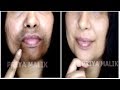 Remove Dark Black patches, Dark Spots Around Your Mouth~ Get Rid Of Hyper Pigmentation | Priya Malik
