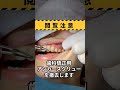 歯科矯正用アンカースクリューの撤去|歯列矯正|Removal of orthodontic anchor screws
