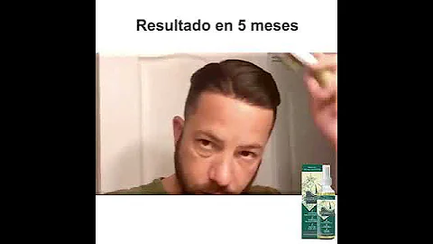 teaser 23851239810420342 videos 0