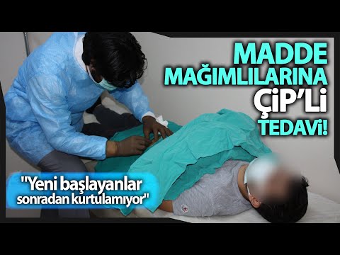 Madde Bağımlıları &rsquo;Çip Tedavisi&rsquo; İle Bağımlılıktan Kurtuluyor