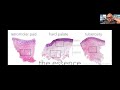 Immediate implants/immediate loading | Long term follow-up (20 years) - Dr Iñaki Gamborena