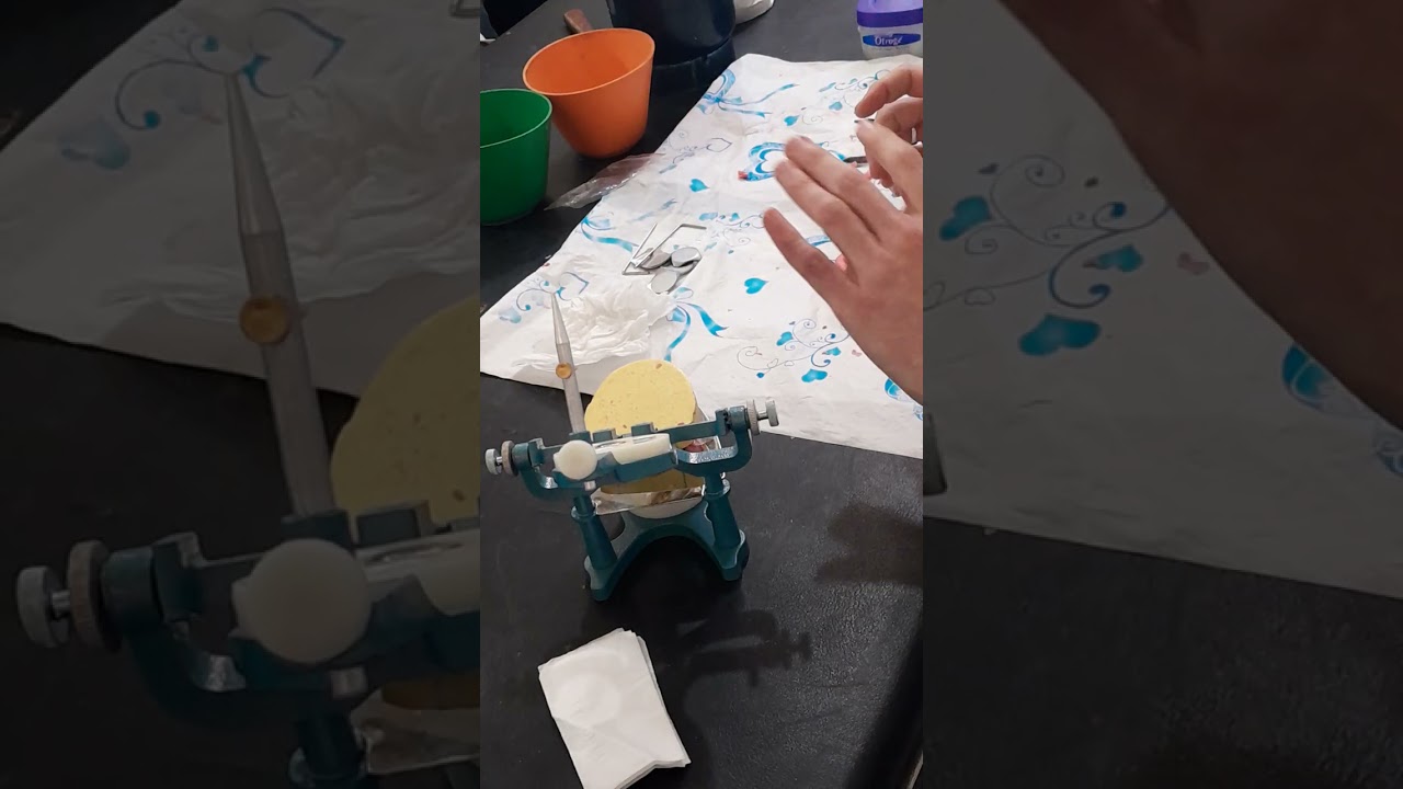 تركيب المثال الجبسي على المطبق  _Installing the gypsum model  on the articular.  3