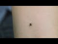 Consumer Reports: Chemical-free ways to limit ticks from your backyard