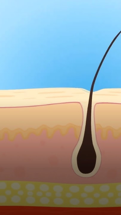 ЛЬНЯНОЕ СЕМЯ: ПОЛЬЗА ДЛЯ ВОЛОС, О КОТОРОЙ ВЫ НЕ ЗНАЛИ #лечениеволос # ...