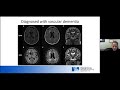 Clinical Case Review: Diagnosis and Management of Non-Alzheimer's Dementias