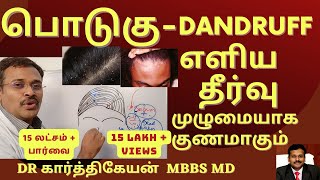 Exercise,Food,hair care home treatment to cure dandruff problem (podugu) in tamil | Dr Karthikeyan