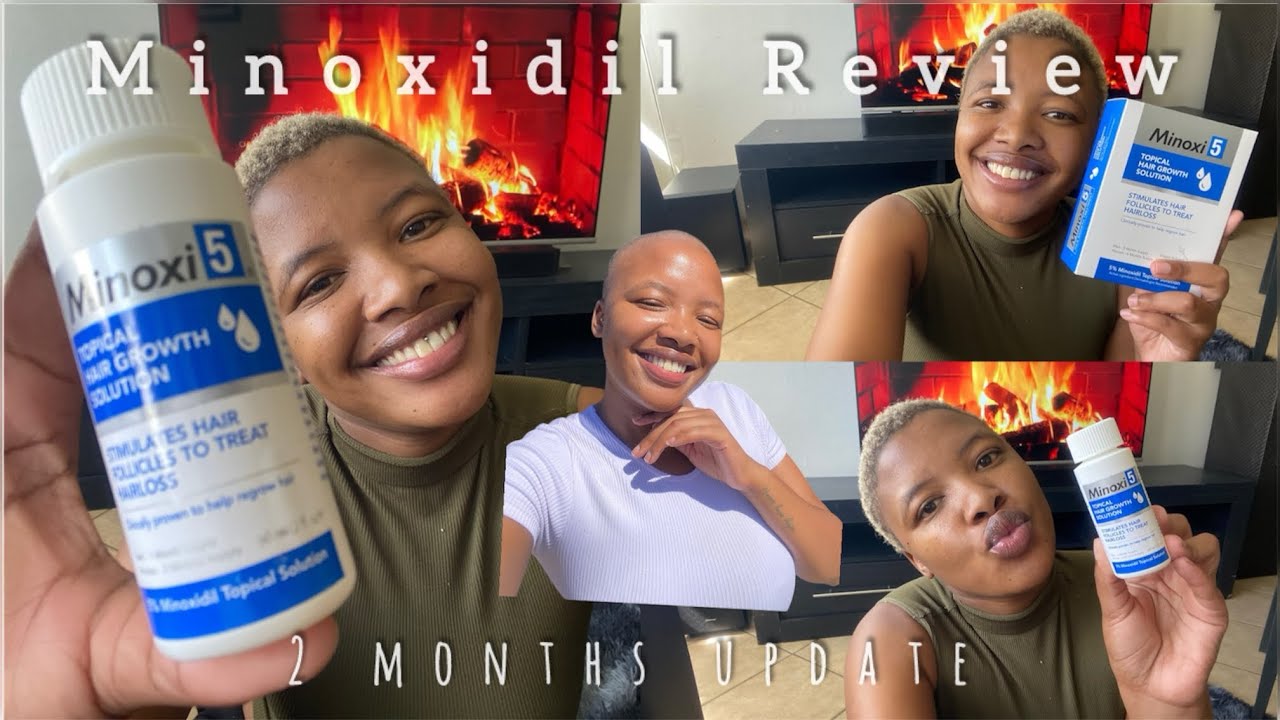 Minoxidil Review ||Side effects?? || How to use minoxidil || South African YouTuber  