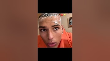 “i will go bald” 😭💔 #marlon #mar3lg #twitchclips #shorts