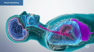 Mouth Breathing: Causes, Diagonosis and Treatment Mouth Breathing: Causes, Diagonosis and Treatment
