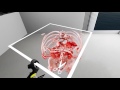 Virtual Reality in Medicine: New Opportunities for Diagnostics and Surgical Planning