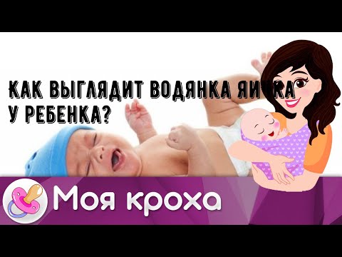 Как выглядит водянка яичка у ребенка?