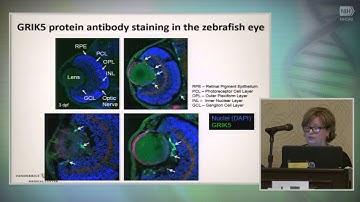 Data Integration: Genome X Transcriptome X EMR - Nancy Cox