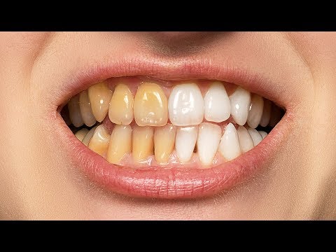 फोटोशॉप में दांतों को सफेद करने का सबसे अच्छा तरीका