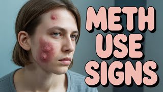 5 Shocking Signs Someone Is On Meth