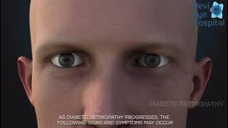 Download lagu DIABETIC RETINOPATHY | Devi Eye Hospital