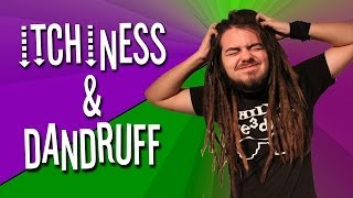 DREADLOCKS DANDRUFF!